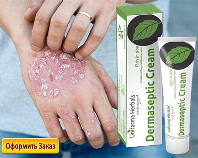 dermaseptic cream цена в аптеках страны