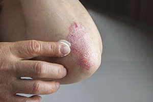 dermaseptic cream содержит уникальную формулу