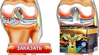 Артропант купить в аптеке