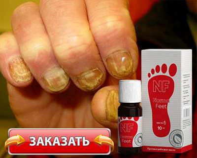 Заказать нормафит на официальном сайте