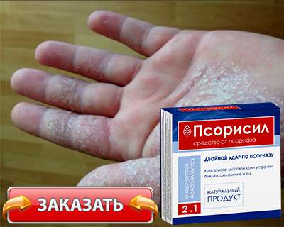 Заказать Псорисил на официальном сайте