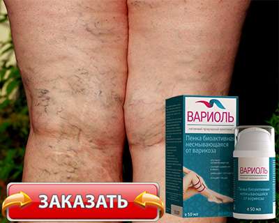 Пенка вариоль купить по доступной цене
