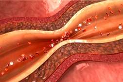 Cardiosoft обладает сосудорасширяющим действием.