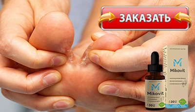 Миковит купить в аптеке.