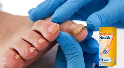 derma-health-ot-gribka