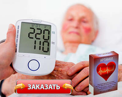 Таблетки Артинол купить по доступной цене.