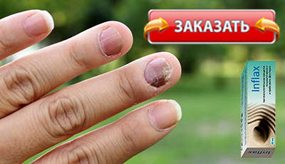 Inflax купить в аптеке.