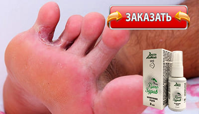 Фунго Здрав купить в аптеке.
